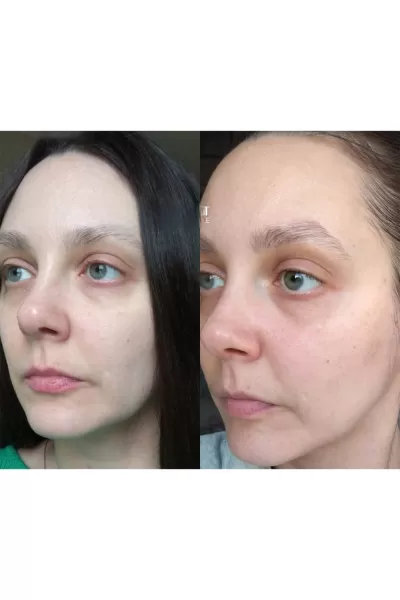  تصویر 7 : اسنس ۹ پپتاید حجم دهنده مدی پیل Medi Peel 