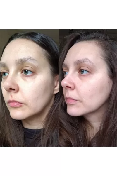  تصویر 8 : اسنس ۹ پپتاید حجم دهنده مدی پیل Medi Peel 
