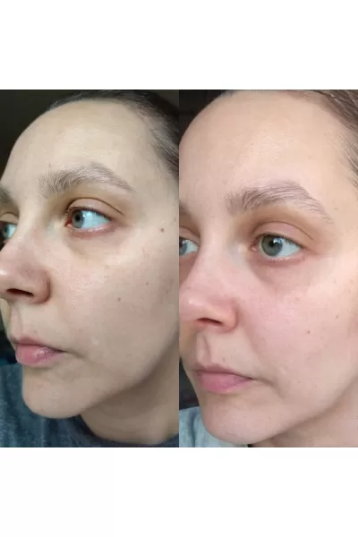  تصویر 9 : اسنس ۹ پپتاید حجم دهنده مدی پیل Medi Peel 