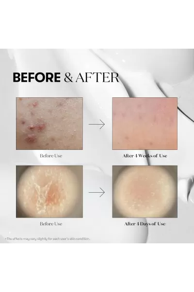  تصویر 4 : سرم میکرونیدلینگ ریدل شات 50 وی‌تی کازمتیک VT Cosmetics 
