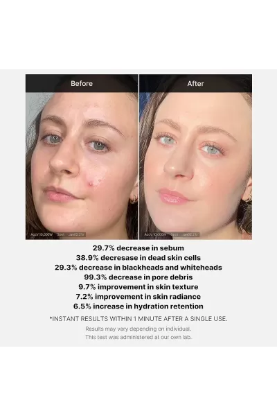  تصویر 1 : سرم برطرف کننده جوش و لایه بردار قرمز مدی کیوب Medicube 