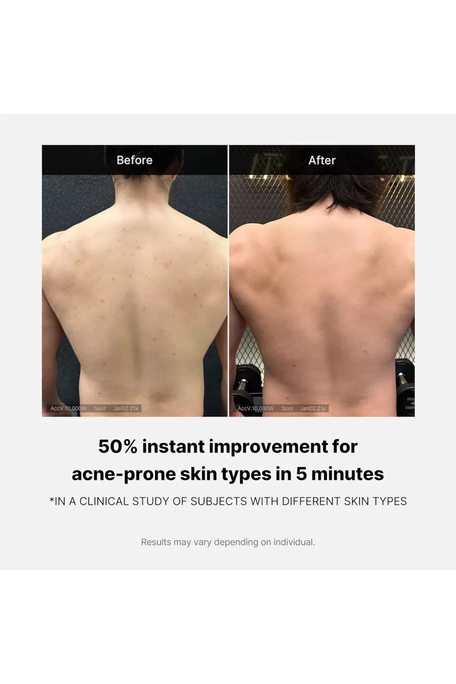 شوینده برطرف کننده آکنه بدن مدی کیوب Medicube مناسب پوستهای مستعد جوش و آکنه بدن شوینده برطرف کننده آکنه بدن مدی کیوب Medicube مناسب پوستهای مستعد جوش و آکنه بدن