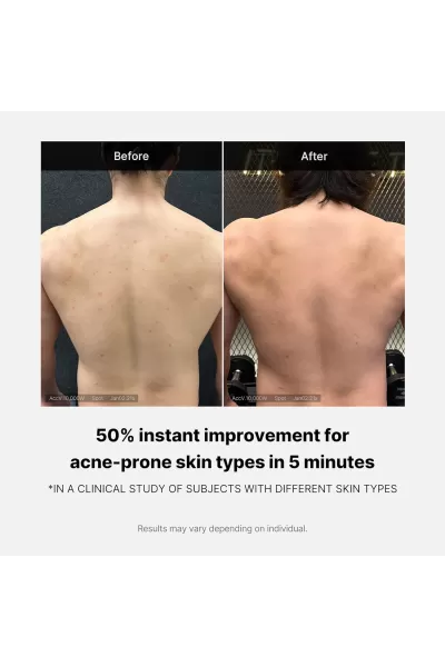  تصویر 4 : Medicube مدی کیوب  شوینده برطرف کننده آکنه بدن  