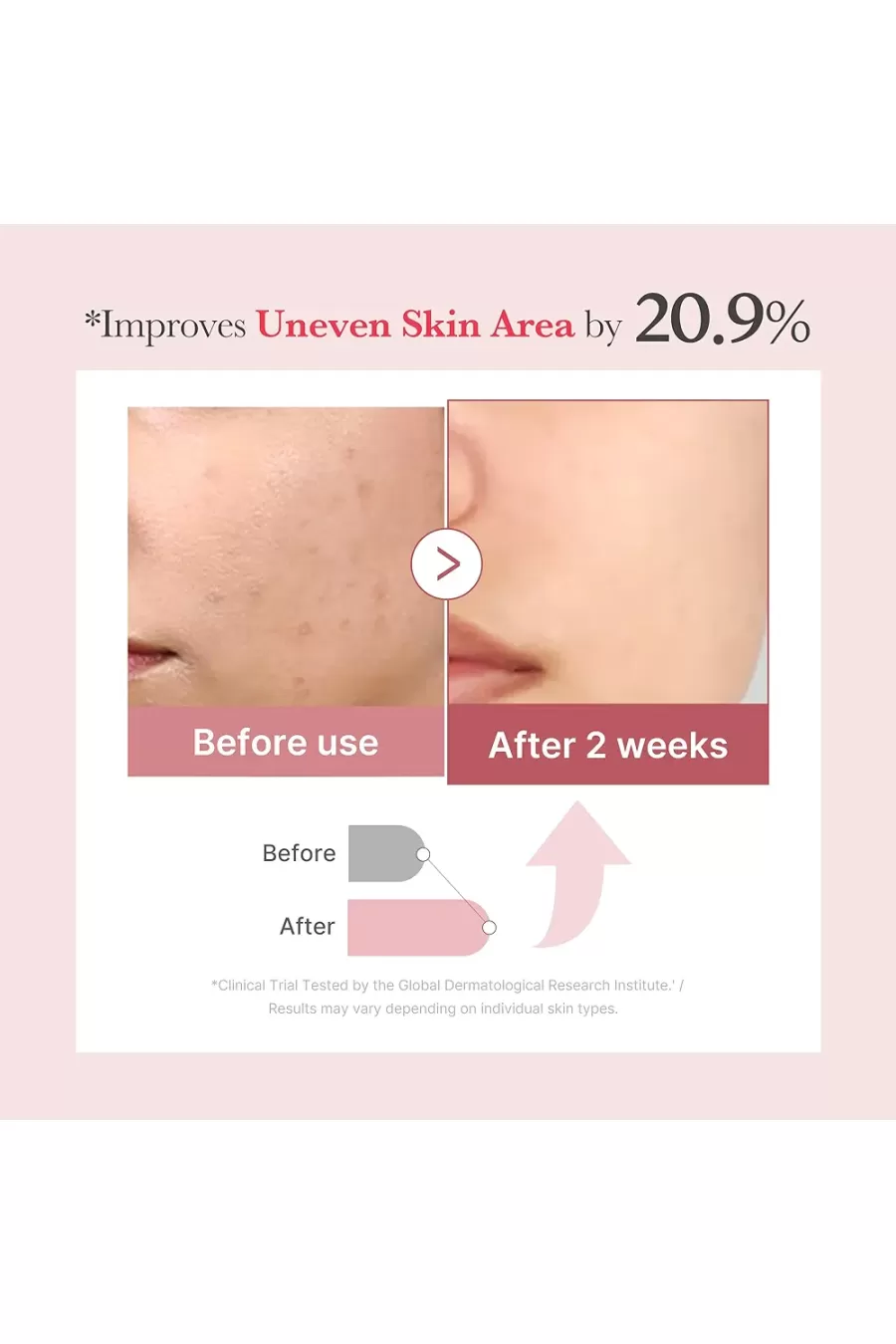 سرم اگزوزوم PDRN کلاژن شات مدی کیوب Medicube مناسب برای پوستهای دارای ناهمواری و لک سرم اگزوزوم PDRN کلاژن شات مدی کیوب Medicube مناسب برای پوستهای دارای ناهمواری و لک