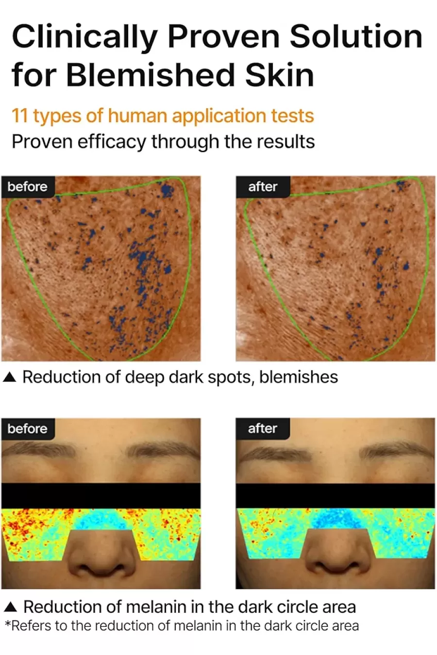 نتایج و نکات استفاده ایمن از کرم ضدلک و روشن کننده سلیمکس Celimax