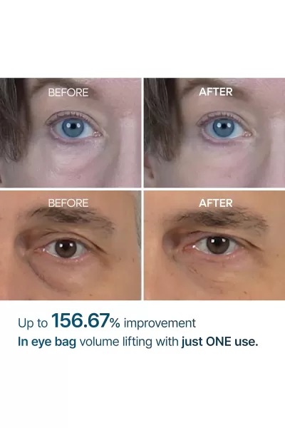 تصویر 1 : Dr.Melaxin دکتر ملاکسین  کرم برطرف کننده پف زیر چشم  