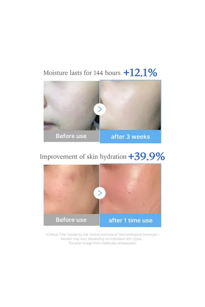  تصویر 3 : سرم هیالورونیک اسید و مولتی پپتاید مدی کیوب آبرسان و جوانساز پوست Hyaluronic Multi Peptide Serum مدی کیوب Medicube 