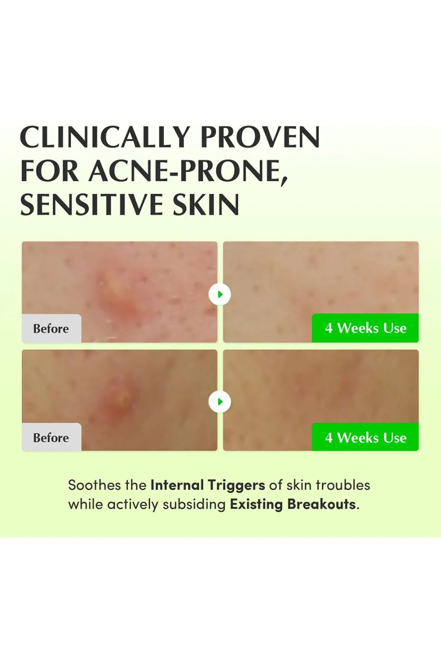 تونر آلوئه ورا تسکین دهنده و ترمیم کننده پوست اکوال بری EQQUAL BERRY مناسب پوست حساس و مستعد جوش تونر آلوئه ورا تسکین دهنده و ترمیم کننده پوست اکوال بری EQQUAL BERRY مناسب پوست حساس و مستعد جوش