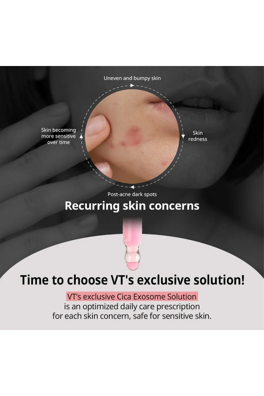 درباره سرم آزلائیک اسید سیکا اگزوزوم ضد جوش و التهاب قوی پوست وی‌تی کازمتیک VT Cosmetics
