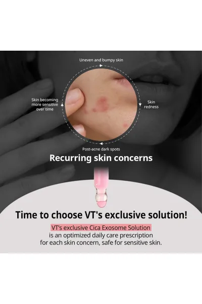 تصویر 2 : سرم آزلائیک اسید سیکا اگزوزوم ضد جوش و التهاب قوی پوست وی‌تی کازمتیک VT Cosmetics 