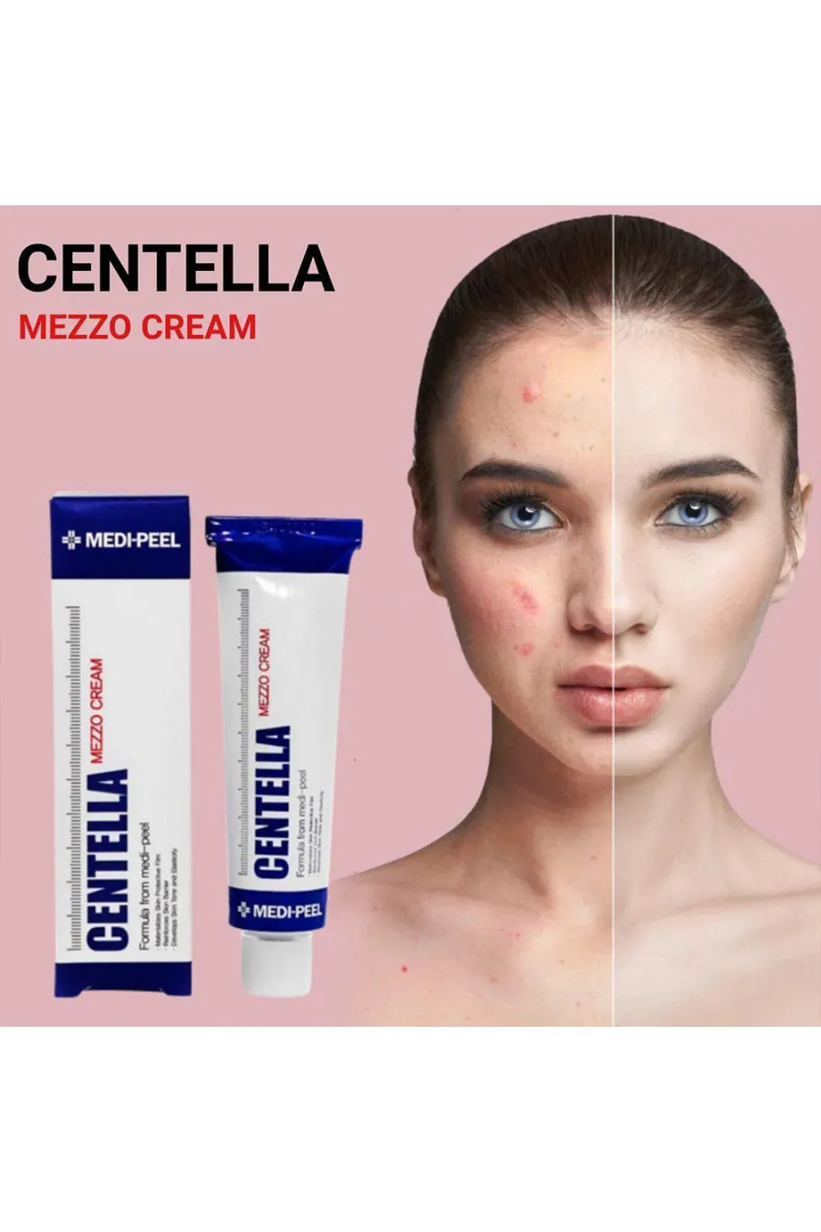ویژگی‌های مزو کرم تسکین دهنده و ترمیم کننده سنتلا مدی پیل Medi-Peel برای مراقبت از پوست