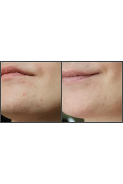  تصویر 5 : کرم مرطوب کننده و روشن کننده آیم فرام I'm from 