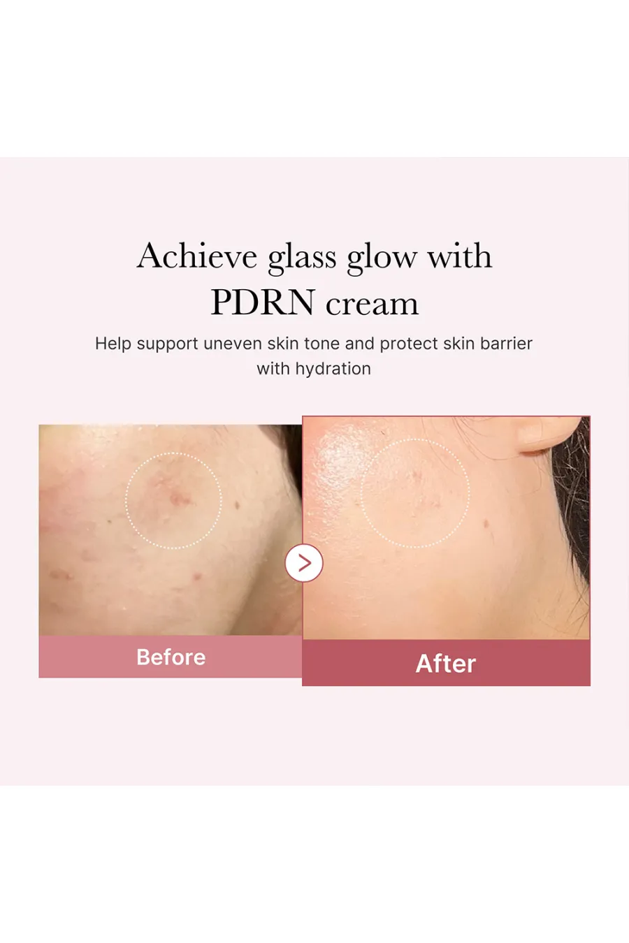 کرم مرطوب کننده هیالورونیک و پیدیآران مدی کیوب Medicube مناسب برای پوست کمآب و کدر کرم مرطوب کننده هیالورونیک و پیدیآران مدی کیوب Medicube مناسب برای پوست کمآب و کدر