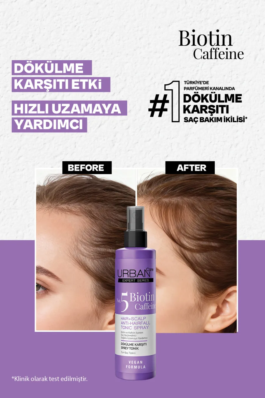 ویژگی‌های کلیدی تونیک مو ضد ریزش و کمک کننده به رشد سریع مو بیوتین و کافئین اوربان کر Urban Care