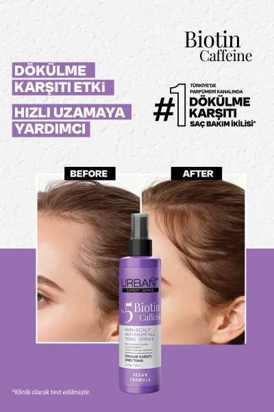  تصویر 2 : Urban Care اوربان کر  تونیک مو ضد ریزش و کمک کننده به رشد سریع مو بیوتین و کافئین  
