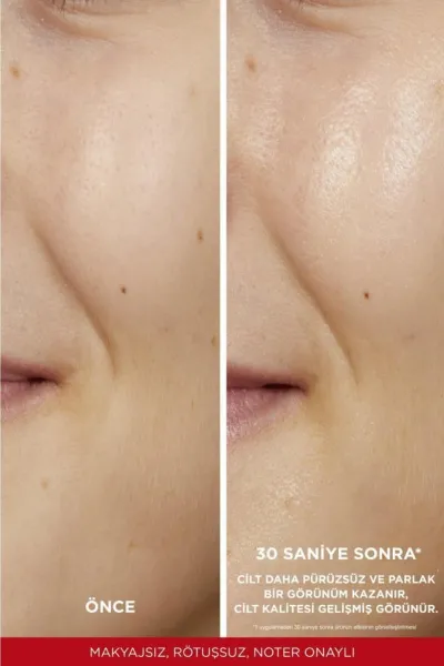  تصویر 4 : تونر گلیکولیک اسید لایه بردار و روشن کننده پوست صورت Revitalift لورال پاریس L'Oreal Paris 