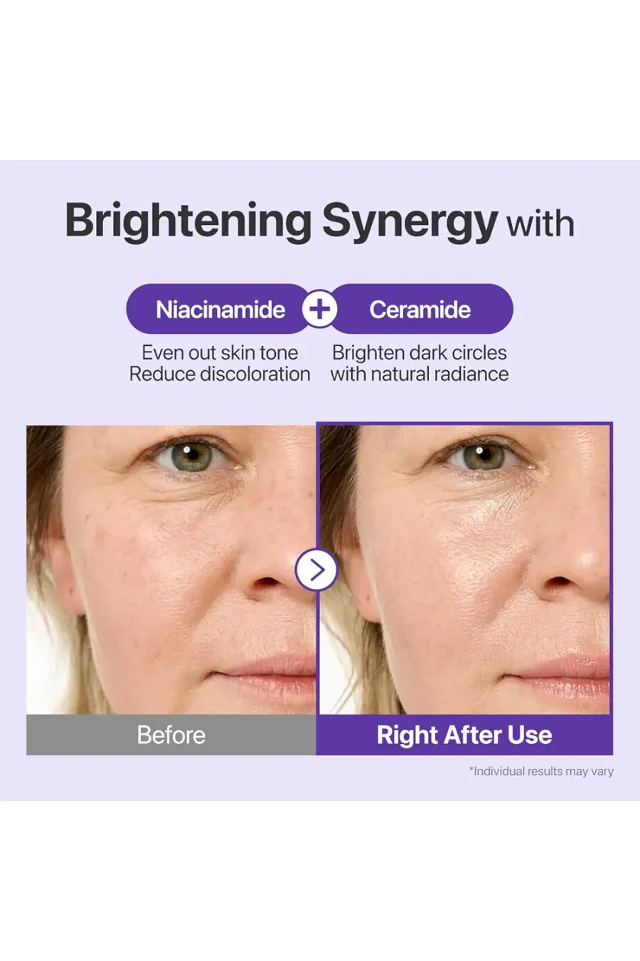 کرم دور چشم رتینال +NAD شماره ۹ ضد چروک روشن کننده و حاوی پپتید نامبوزین Numbuzin No.9 NAD+ Retinal Eye Cream مناسب چه کسانی است؟ کرم دور چشم رتینال +NAD شماره ۹ ضد چروک روشن کننده و حاوی پپتید نامبوزین Numbuzin No.9 NAD+ Retinal Eye Cream مناسب چه کسانی است؟