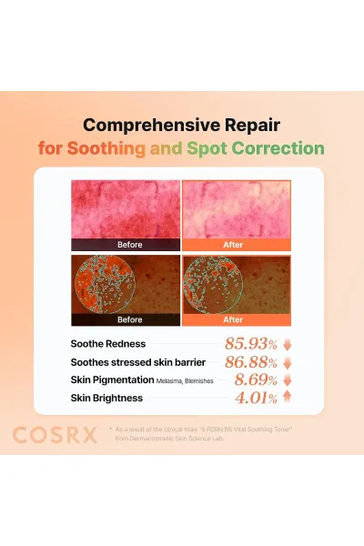  تصویر 6 : تونر شماره 5 آبرسان ترمیم کننده و تسکین دهنده PDRN B5 کوزارکس COSRX 