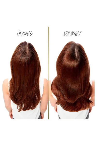  تصویر 2 : Pantene پنتن  شامپو ضد شوره  