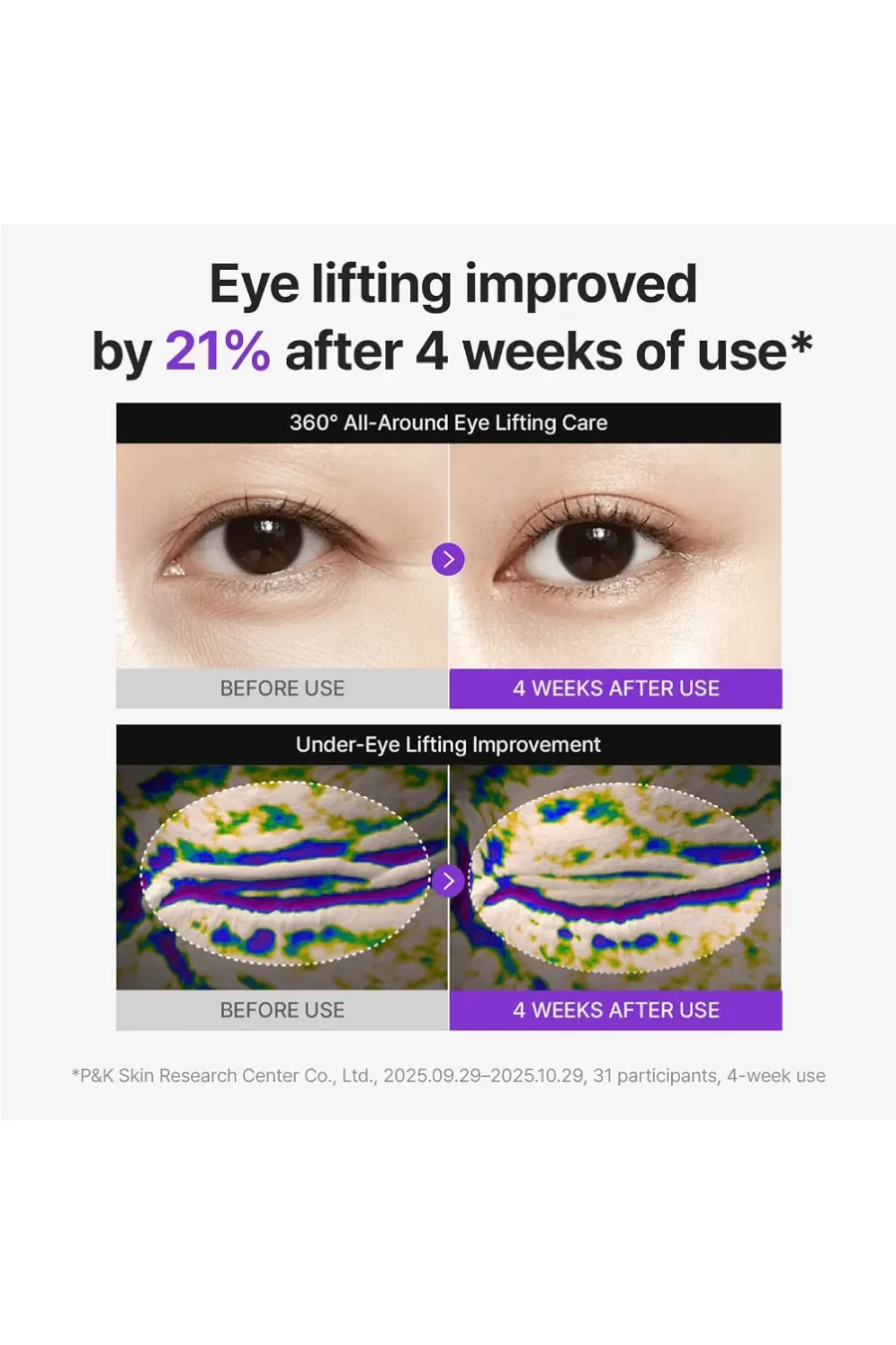مزایای استفاده از کرم دور چشم شات لیفتینگ و ضدچروک PDRN سنتلین 24 Centellian24 360º Shot PDRN Eye Cream مزایای استفاده از کرم دور چشم شات لیفتینگ و ضدچروک PDRN سنتلین 24 Centellian24 360º Shot PDRN Eye Cream