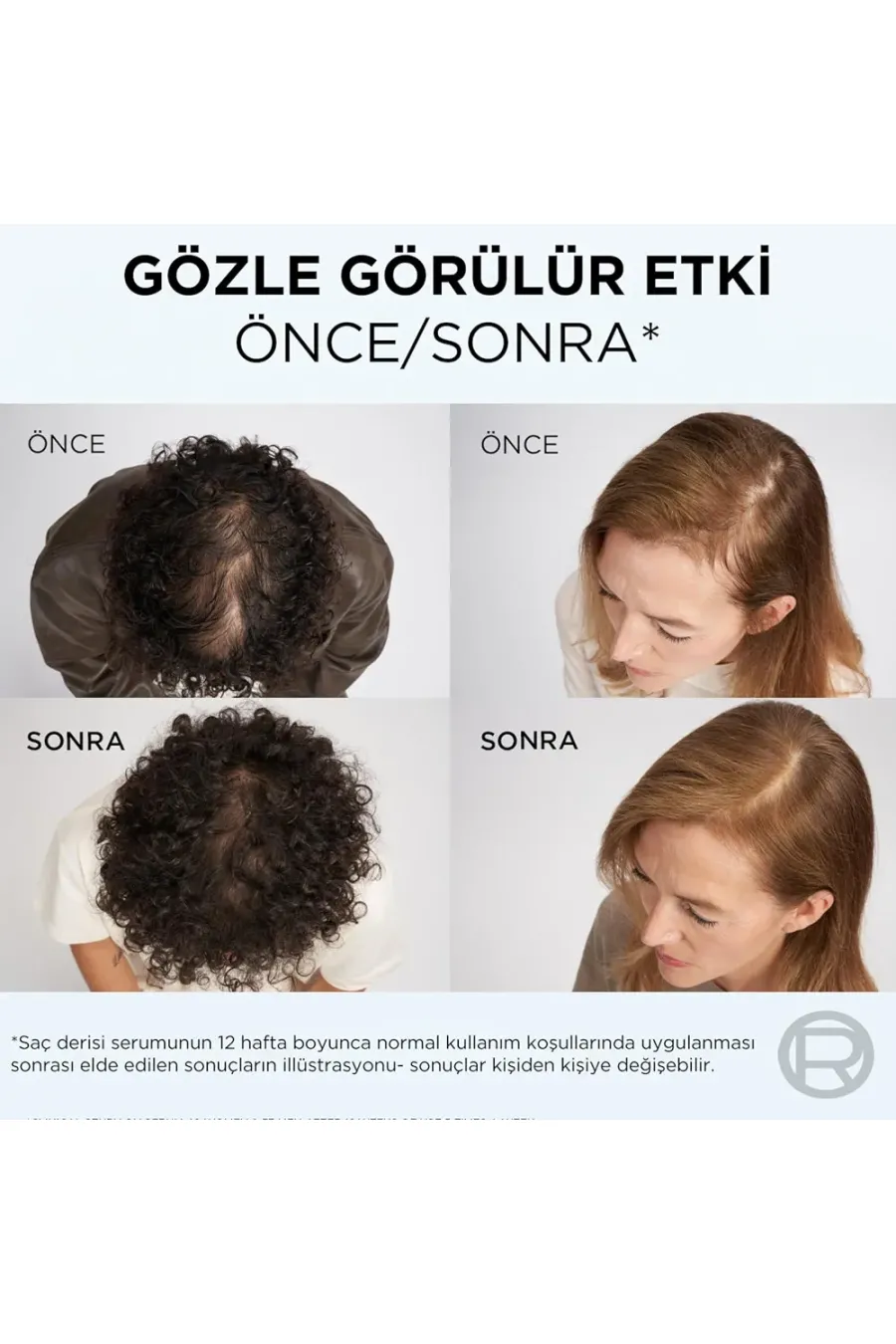 مزایای استفاده از سرم ضد ریزش و تقویت‌کننده پوست سر السیو لورال پاریس L'Oreal Paris