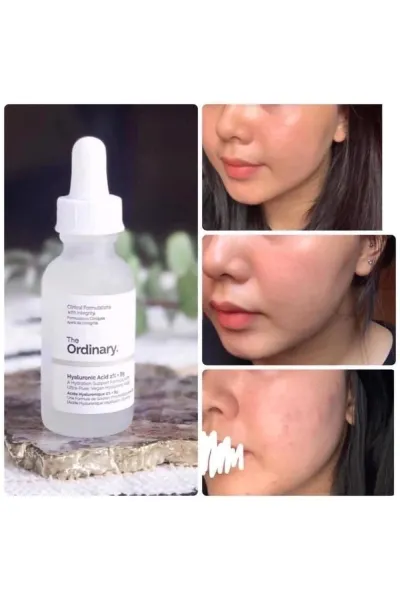  تصویر 11 : سرم آبرسان هیالورونیک اسید ۲ درصد اوردینری The Ordinary 