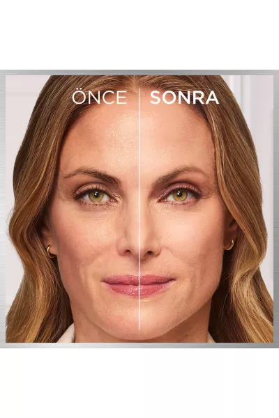  تصویر 9 : کرم پودر بالم رنگ Rosy Light روشن گل‌بهی با پوشش طبیعی و یکدست لورال پاریس L'Oreal Paris 