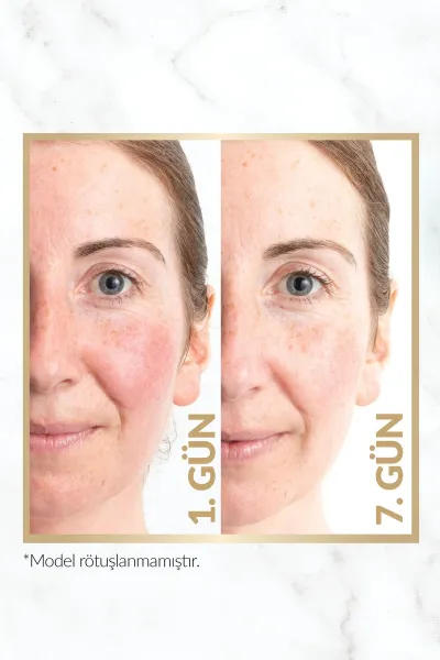  تصویر 4 : سرم جوانساز + کلاژن ساز با اثر فوری در ۷ روز ANEW آوون AVON 