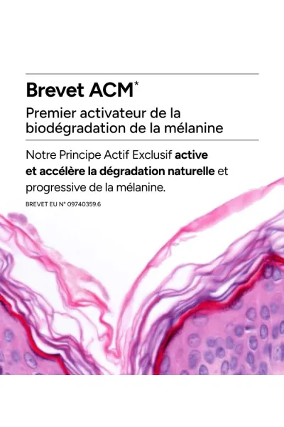  تصویر 4 : ACM ای سی ام  کرم برطرف کننده لک  