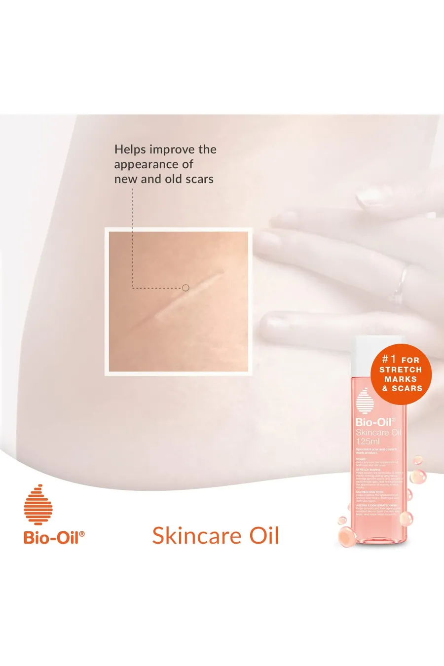 گرفتن بهترین نتیجه از روغن ترمیم کننده پوست بایو اویل Bio-Oil برای بهبود ظاهر جای زخم گرفتن بهترین نتیجه از روغن ترمیم کننده پوست بایو اویل Bio-Oil برای بهبود ظاهر جای زخم