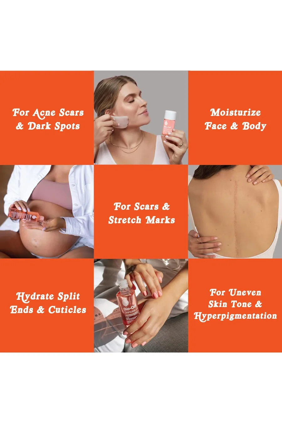 روغن ترمیم کننده پوست بیو اویل Bio-Oil مناسب جای زخم، ترک پوستی، خشکی و ناهمگونی رنگ پوست روغن ترمیم کننده پوست بیو اویل Bio-Oil مناسب جای زخم، ترک پوستی، خشکی و ناهمگونی رنگ پوست