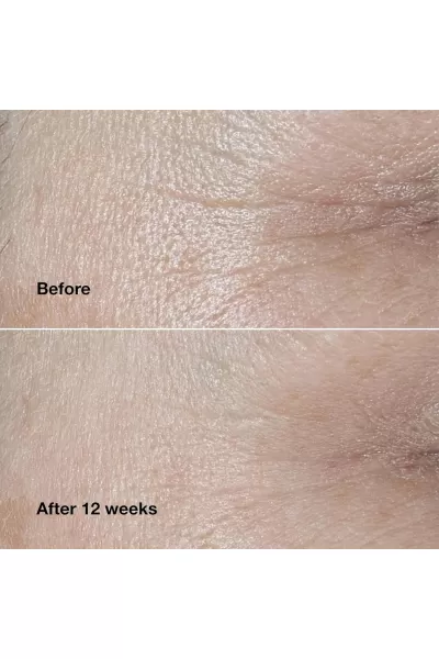  تصویر 2 : Clinique کلینیک  کرم ضد چروک دور چشم اسمارت  