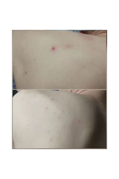  تصویر 4 : SOME BY MI سام بای می  شوینده بدن برطرف کننده جوش  