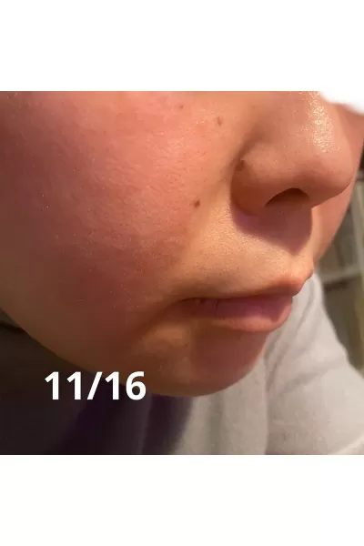  تصویر 10 : کرم رتینول ضد چروک صورت و دور چشم 0.1 کوزارکس COSRX 
