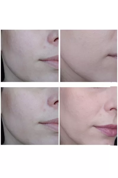  تصویر 12 : Heimish هیمیش Spf 30 light beige 21 بی‌بی کرم سرامید حاوی  