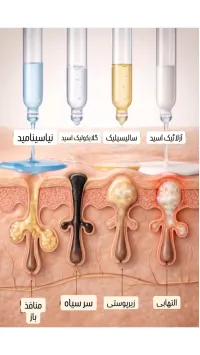 درمان انواع جوش